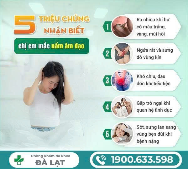 Hình ảnh minh họa